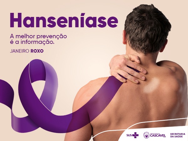 Janeiro Roxo: Perguntas frequentes sobre a Hanseníase - Escola